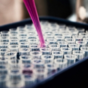 analisi di laboratorio